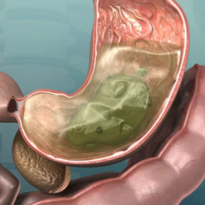Jian Care Madu Maghat: Solusi Meningkatkan Nafsu Makan & Mengobati Maag Kronis