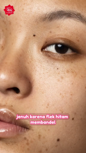 [BPOM] VIVA Whitening Cream with Whitening Complex Agent Brighten Skin Prevent Blackhead - 15g