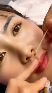 Kem Tẩy Nốt Ruồi 5G Da Thẻ Tẩy Mụn Cơ Thể