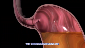 Gerdafost Bharata Obat Gerd Tukak Lambung Maag Kronis Ampuh 100% Asli Bergaransi BPOM dan Halal MUI