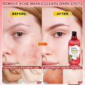 BUY 1 TAKE 1 500ml Arbutin Body Serum For Skin Whitening Brightening Niacinamide To Improve Dull Skin Tone Serum For Face Skin Care Essence Acne Skin Repair Moisturizer Whitening Bleaching Lotion Underarm Gentle Firming Repair Skin. 