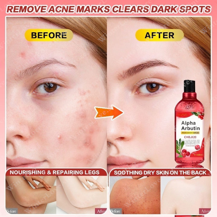 BUY%201%20TAKE%201%20500ml%20Arbutin%20Body%20Serum%20For%20Skin%20Whitening%20Brightening%20Niacinamide%20To%20Improve%20Dull%20Skin%20Tone%20Serum%20For%20Face%20Skin%20Care%20Essence%20Acne%20Skin%20Repair%20Moisturizer%20Whitening%20Bleaching%20Lotion%20Underarm%20Gentle%20Firming%20Repair%20Skin%20-%20Image%203