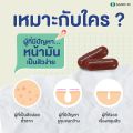 HandyHerb Vit2go ZinC วิตทูโก ซิงค์ คุ้มค่า ทานประจำคุ้มกว่า ไร้สิว ผิวไม่มัน. 