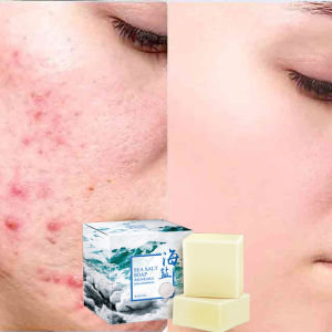 100g Sea Salt Soap Removal Pimple Pores Acne Treatment Cleaner Moisturizing Goat Milk Face Wash Soap Effectively Remove Mites Improve Skin Anti-Acne Whitening Face Wash Soap Treatment Cleaner removes blackheads