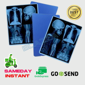 Gosend Sameday Dry Film Inkjet Medical Digital Radiology Rontgen X-Ray Bluebase ukuran A4 100 sheet