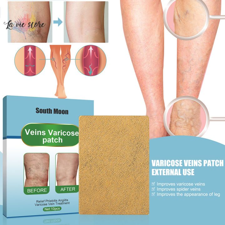 [La vis] Intravenous Health Patch For Leg Pain And Swelling Relief For ...