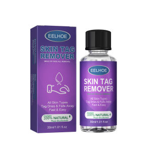 Eelhoe Removing Calluses On Hands And Feet Removing Calluses On Feet Removing Calluses On Feet Removing Calluses On Feet Removing Chicken Foot Pads Piercing Eyes Warts And Plantar Warts Wart Removal Liquid Skin Cleansing Meat Thorns Painless Wart Removal