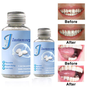 SINGLE DIY False Teeth Solid Glue Repair Dental Decorative Denture Tooth Replacement Material Tooth Repair Kit Denture Solid Tooth Gel Temporary Tooth Filling Material