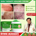 gamot sa kati kati sa balat skin fighter atoderma cream original ointments and creams eczema treatment dermacare cream for psoriasis skin deases antibacterial cream. 