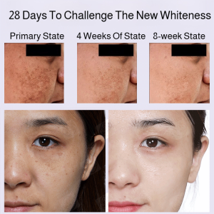 Herbal Whitening and Spot Removal Cream for Adults Even Skin Tone Brightens Complexion Reduces Dark Spots in 3 Days