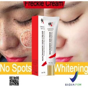 BPOM CINDYNAL Niacinamide Whitening Cream - Pelembab & Penangkal Flek Wajah