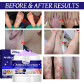 Antibacterial Cream Eczema Treatment Cream Atoderma Cream Original Fungisol Anti Fungal Cream Anti Itch Cream. 