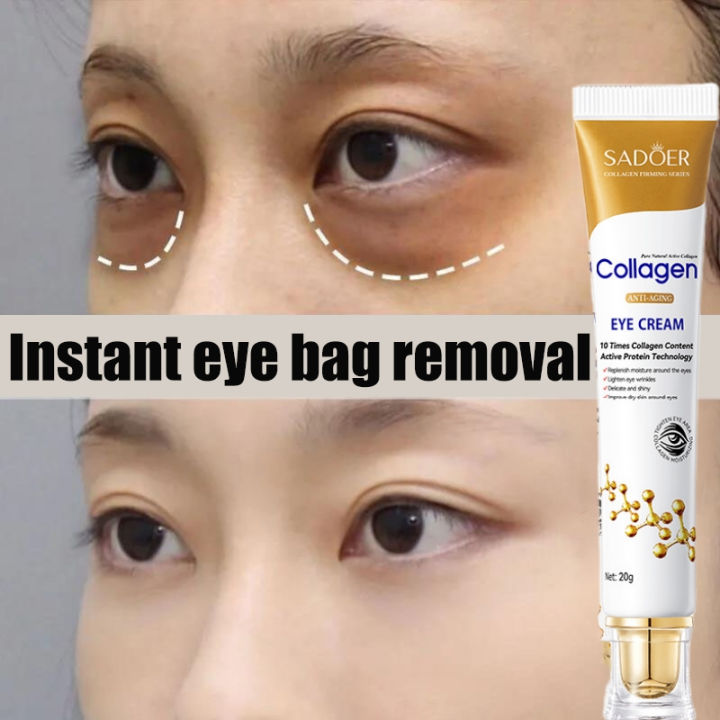 Collagen Eye Cream 20g Eye Bag Remover Wrinkle Dark Circle Anti