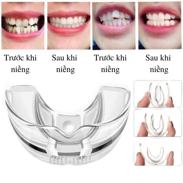 [HCM][BÁN GIÁ GỐC]-HÀM LẺ A2 BỘ NIỀNG RĂNG TRAINER TẠI NHÀ CHO NGƯỜI LỚN |A1|A2|A3| NIỀNG RĂNG TRONG SUỐT| DỄ THÁO LẮP VỆ SINH| ĂN UỐNG KHÔNG LO DÍNH RĂNG