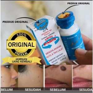 Penghilang Perontok Tahi Lalat Paling Ampuh Original