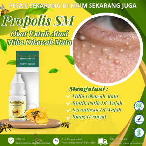 Produk Propolis Sm - Obat Milia Penghilang Bintik Putih di Bawah Mata Xhantelasma Beruntusan di Wajah
