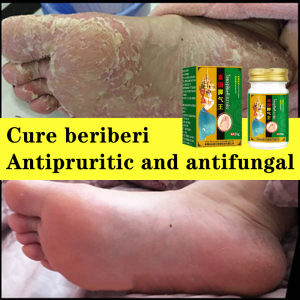 Remove beriberi Cream anti Itching foot cream 脚气膏 For Foot odor foot sweat itchy feet flaking feet external application