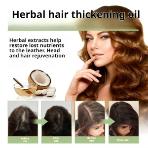 Minyak Perawatan Rambut Herbal untuk Meningkatkan Kepadatan dan Kekuatan Rambut Minyak Perawatan Rambut untuk Mencegah Rontok dan Membersihkan Kulit Kepala Minyak Perawatan Rambut untuk Merawat dan Melembutkan Rambut