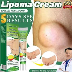 【100% Effective】Lipoma Removal Cream Treats Tumor-Related Skin Swelling Natural Herbal Ointment Relieves Pain Clears And Dissolves Effectively Reduces Subcutaneous Lumps