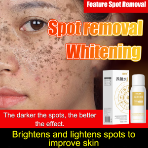 💎All Kinds Of Spots Can Be Removed With One Spray💎Blemish Removal And Whitening Spray/MultiAction Aurora Beauty Skin Care Water/Pore Refining Antioxidant Toner