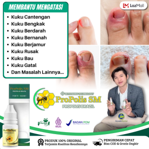Obat Tetes Cantengan Obat Kuku Kaki Cantengan Obat Kuku Bengkak Bernanah Obat Kuku Rusak Obat Cantengan Parah Dan Bau Obat Cantengan Jempol Kaki Obat Kuku Jamuran - Propolis SM Brazil Asli