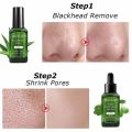 BREYLEE Step 1 Blackhead Remover Mask /Masker komedo Ampuh Mengangkat Komedo Hitam Bandel /  Step 2 Serum Menyusut Pori-pori - Breylee Blackhead Mask - Breylee Serum. 