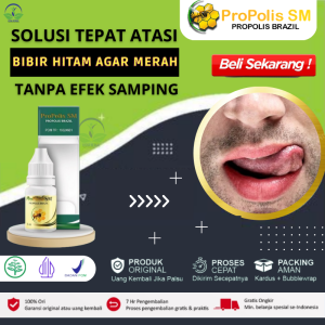 Solusi Penghilang Bibir Menghitam Obat Oles Buat Bibir Hitam Jadi Merah Cairan Pembersih Bibir Hitam Cowok Obat Tetes Pemerah Bibir Yang Hitam Obat Untuk Menghilangkan Bibir Hitam Obat Bibir Hitam Pria Perokok Atasi Dengan Propolis SM Brazil Original
