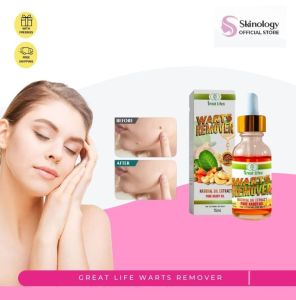 Warts Remover Pure Kasoy Oil 10ml By Great Life Natural Oil Extract Skin Problem Solution Removes Skin Tags Nunal Kulugo Buni An An Proven And Safe Easy To Use Safe To Use