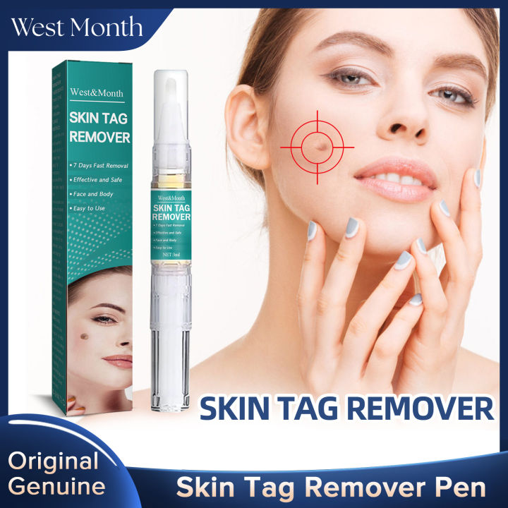 West Month Skin Tag Remover Pen Warts Liquid Skin Tag Ointment Remover ...