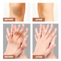 Eelhoe Strong Effective Dark Knuckles Remover Serum Powerful Whitening Cream Hand Knuckle Cream For Elbow And Knee Black Skin Dark Feet Whitening Cream Fast Whitening Cream For Dark Feet Dark Knees And Elbows Strong Whitening Cream 50g. 