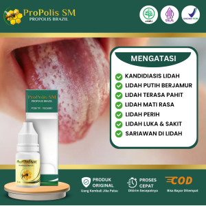 Obat Lidah Berjamur Lidah Putih Mati Rasa Pahit Sariawan Kandidiasis Anak dan Dewasa Propolis SM