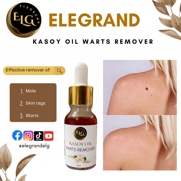 Elegrand Pure and Organic Kasoy Oil Warts Remover Herbal Nunal Remover