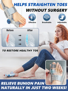 [No surgery required] Hallux valgus corrector