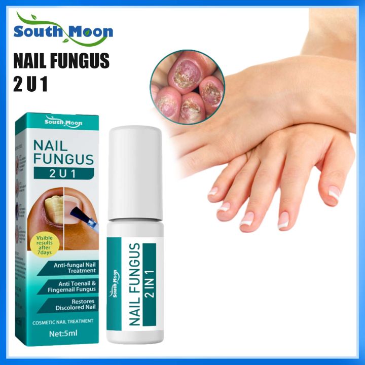 South Moon Nail Fungus Antibacterial Repair Liquid Effective Nutritious ...