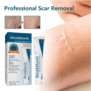 H Mencerahkan parut merawat kulit hamil dan meremajakan kulit