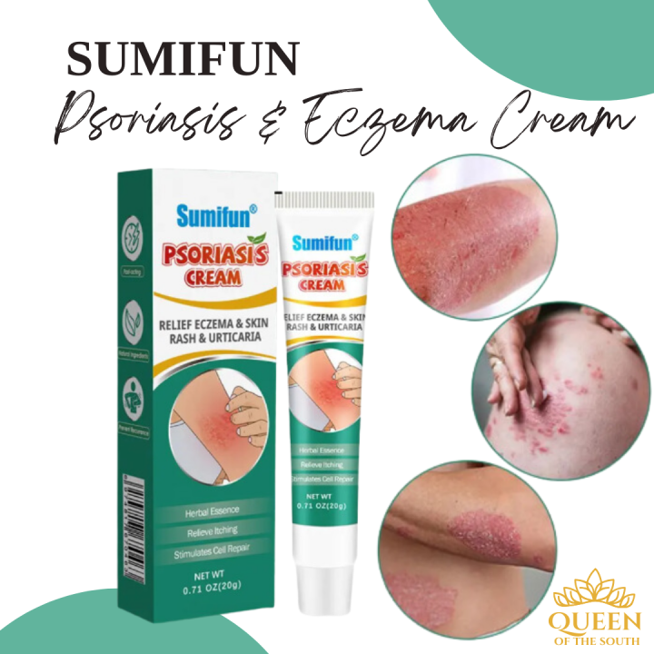 Sumifun Psoriasis Cream Relief Eczema Skin Rash Urticaria Treatment ...