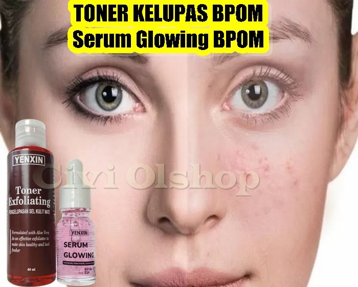 Serum yang di formulasikan khusus untuk mengatasi milia Serum AHA BHA ...