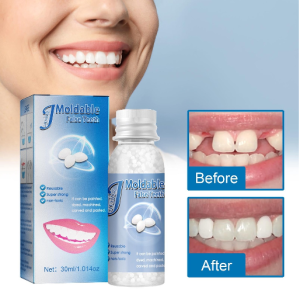 💥💥💥 PROMOSI!!Diy Gigi Palsu Temporary Tooth Repair Kit Teeth And Gaps FalseTeeth Solid Glue 假牙胶囊 假牙牙胶
