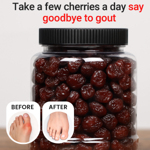 250g Can Dried Cherry Snacks No Additives Premium Baked Cherry for Arthritis and Gout Support