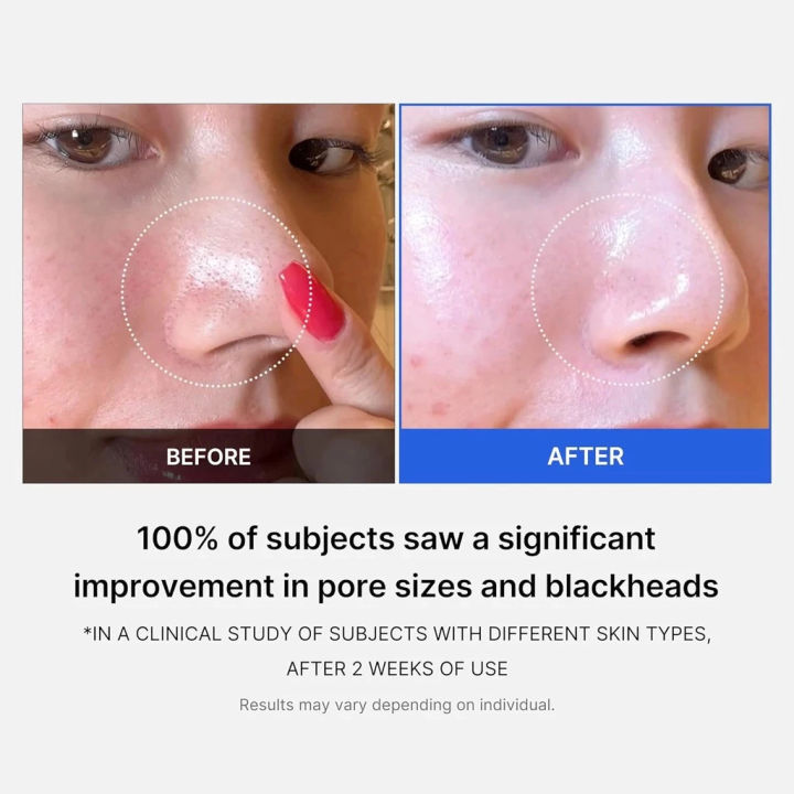 Medicube%20Dual-Textured%20Toner%20Pads%20-%20Gentle%20Exfoliation%20&%20Pore%20Refining%2070pcs%20-%20Image%206