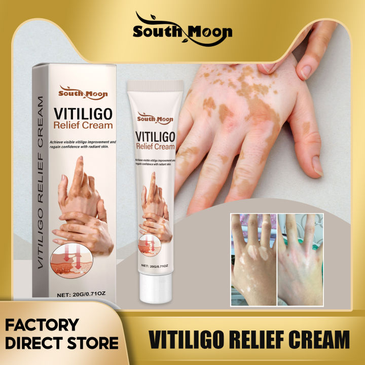 South Moon Vitiligo Repair Cream Pigmentation Corrector Cure Mycosis Photo Inspiration