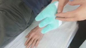 Ngón tay contracture đệm Cone với phân cách các ngón tay tay nắm bệnh nhân cho lòng bàn tay Grip tay contracture đệm cho PAL