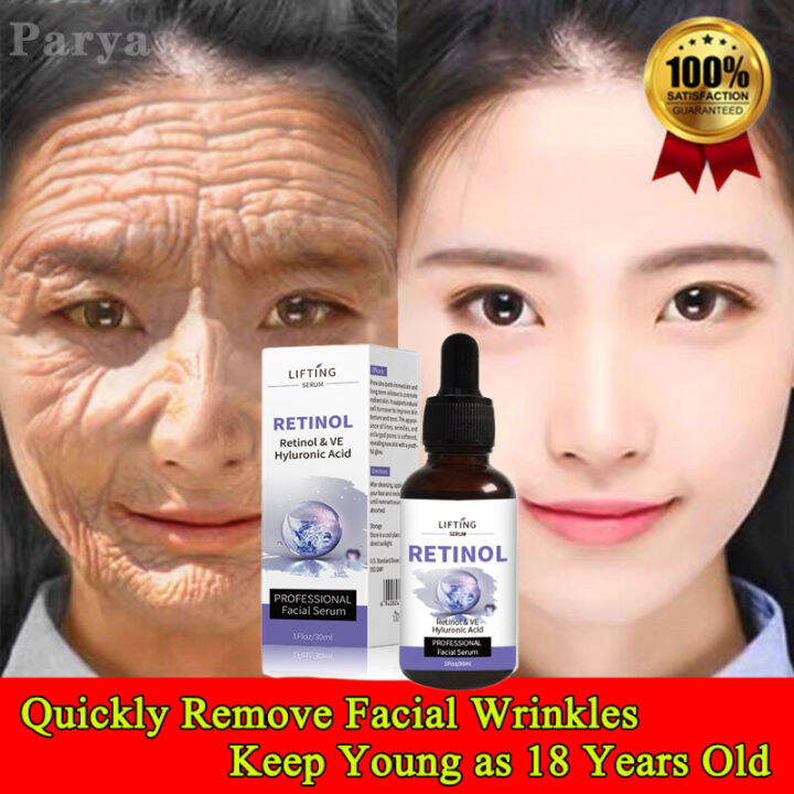 Retinol Facial Serum Anti Wrinkle Remove Dark Spots Bright Triple Glow Skin Brightening Facial Serum for Glowing Skin with retinol 30ml Lazada PH