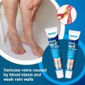 SUMIFUN Varicose Veins Removal Cream Varicose Veins Patch Varicose Veins Treatment Varicose Veins Cream Varicose Remover. 