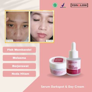 Yonglow Skincare Paket 2in1 Serum Darkspot Day Cream Krim Siang Resmi BPOM Formulasi dr Yong Serum Penghilang Flek Melasma Membandel Serum Penghilang Noda Hitam Pemutih Kulit Wajah Glowing