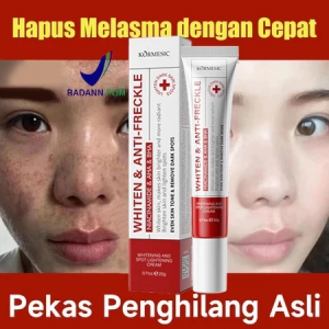 Krim Niacinamide Pencerah 20g krim pencerah dan penghilang noda cocok untuk penggunaan siang dan malam. Krim ini menyamarkan noda hitam memiliki sifat anti-penuaan dan anti-kerut serta membantu menyamarkan bekas jerawat. BPOM