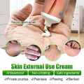 KanyeHB ointment for itchy skin and allergy 20g For the treatment of pruritic dermatitis,eczema, inner thigh skin diseases anti fungal cream Private itching cream Private Antibacterial Ointment Gamot sa kati kati sa balat cream anti itch cream for private. 
