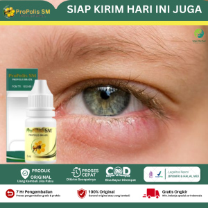 Obat Mata Bengkak Pengempis Bengkak Di Kelopak Mata Penghilang Mata Bintilan Bernanah Kalazion Cendo Luar Dalam Hordeolum Pada Anak Dan Dewasa Benjolan Di Mata Gatal Merah - Propolis SM