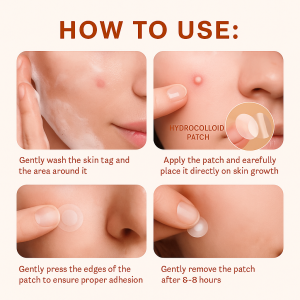 【แผ่นแปะกำจัดหูดแบบรวดเร็ว】144PCS พลาสเตอร์กำจัดหูดจากพืช กำจัดหูดแบบไม่เจ็บปวด กำจัดเท้าด้วยสารต้านแบคทีเรีย