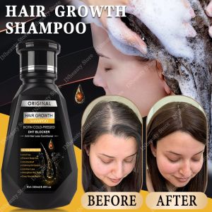 Hair Growth Ginger Shampoo 250ml Anti-Hair Loss Biotin Protect Scalp Natural Extracts Ketoconazole Hair Thickener